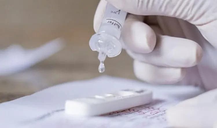 Anvisa adia liberação de autotestes para covid no Brasil