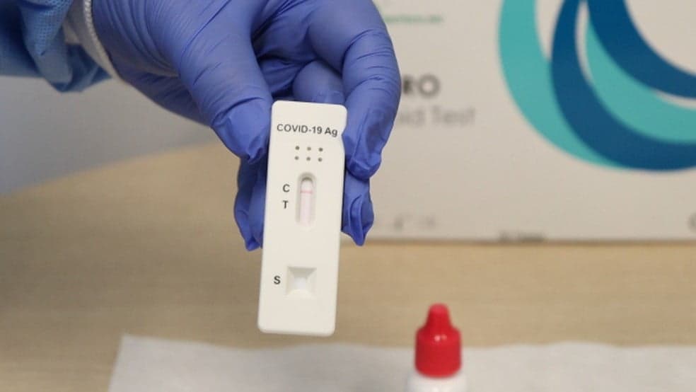 Planos de saúde são obrigados a cobrirem testes rápidos de Covid-19