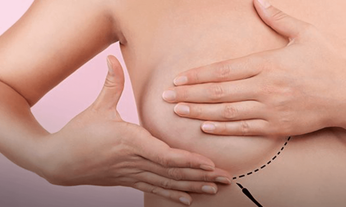 Projeto acompanha pacientes com câncer de mama