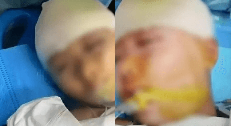 Professor agride aluna com régua de ferro na cabeça, na China