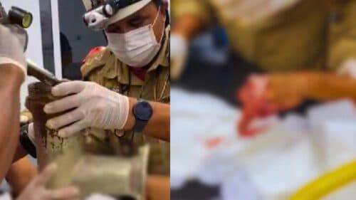 VÍDEO: Funcionário perde a mão &#8216;triturada&#8217; em máquina de moer carne, em Manaus