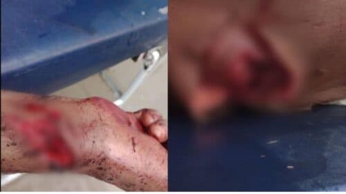 BRUTALIDADE: Morto a &#8216;terçadadas&#8217;, homem quase tem a cabeça decapitada, no AM