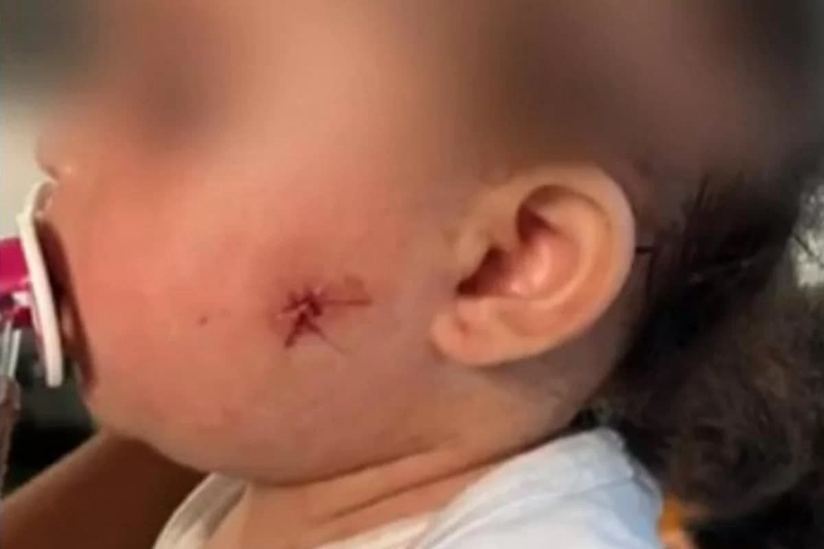 VÍDEO: PM de SP afasta agentes envolvidos em caso do tiro de airsoft que atingiu rosto de bebê