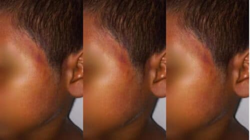 Criança de 10 anos é espancada pelo próprio tio com golpes de sandália, em Roraima