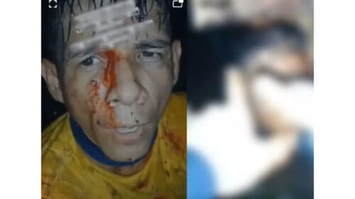 VÍDEO: Homem é esquartejado e tem a cabeça arrancada pelo &#8216;tribunal do crime&#8217;, em Manaus