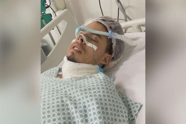 Homem passa 4 dias em UTI após extrair dentes do siso com aluna de Odontologia da UNESP
