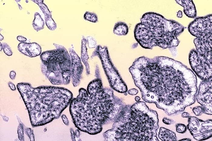 Adolescente de 14 anos morre após contrair vírus Nipah na Índia