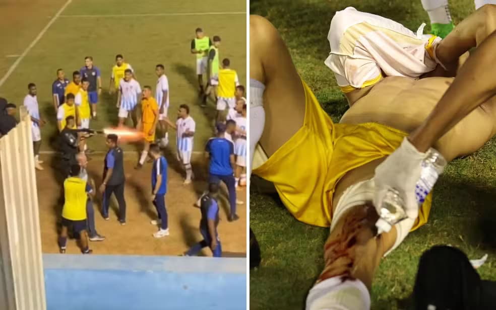 Ministério do Esporte repudia ação de PM que atirou em goleiro do Grêmio Anápolis