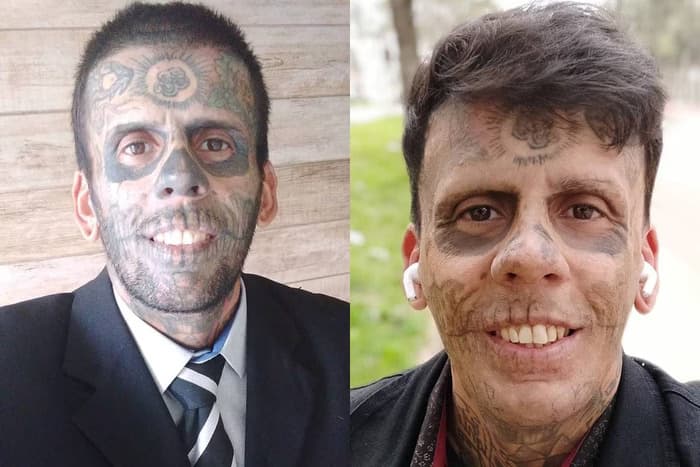 SP: &#8220;Homem mais tatuado do Brasil&#8221; se converte e começa a apagar tatuagens do rosto