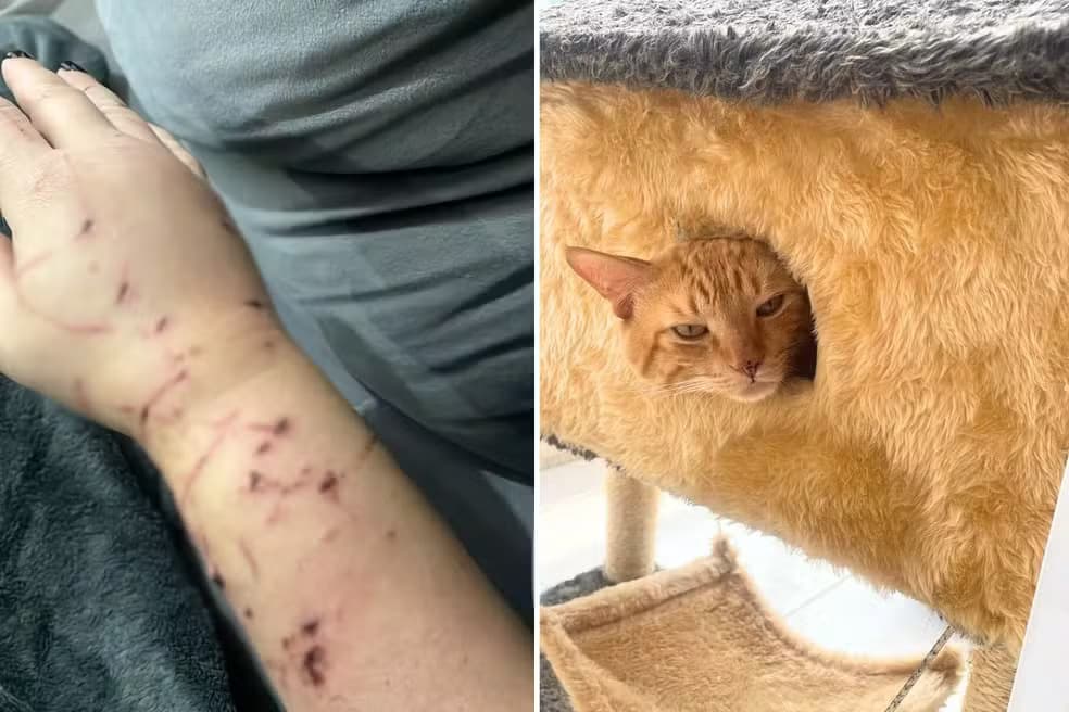 SP: Gato dilacera braço de tutora e faz família de &#8220;refém&#8221; dentro da própria casa