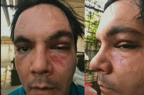 Caso Mateus: autista é espancado após ser confundido com ladrão em Manaus