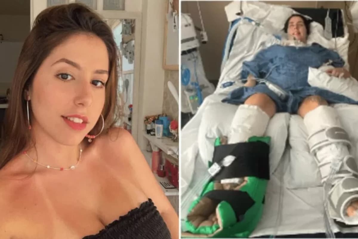 Brasileira fala sobre recuperação depois de ficar paralisada ao tomar sopa nos EUA: &#8220;Foi só uma colher&#8221;