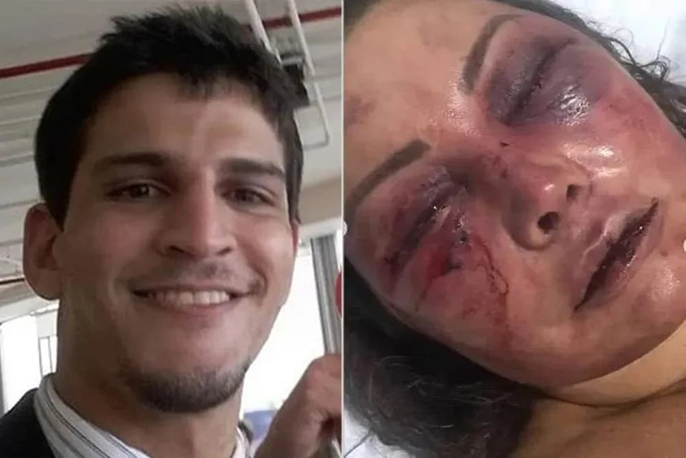 Homem que espancou mulher durante o sono é absolvido pela Justiça do RJ: Entenda o que é &#8216;parassonia&#8217;
