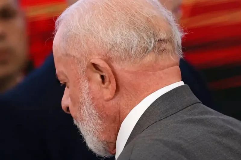 Presidente Lula deixa UTI, informa novo boletim médico