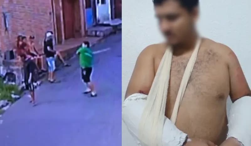 VÍDEO: Homem tem braços quebrados por criminosos após agredir morador de rua