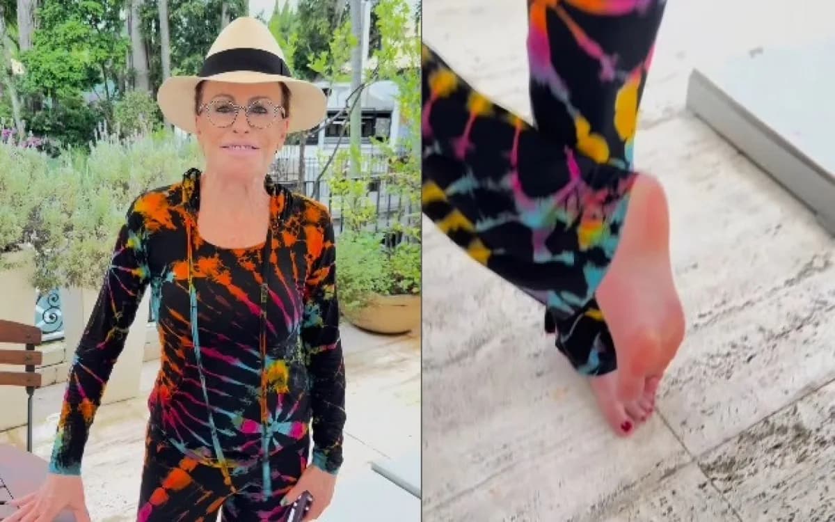 Ana Maria Braga atualiza estado após ser picada por escorpião