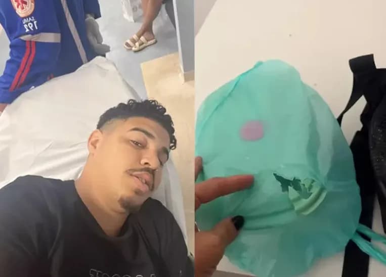 Barbeiro é salvo por marmita em tentativa de assalto: &#8220;quase fiquei paraplégico&#8221;