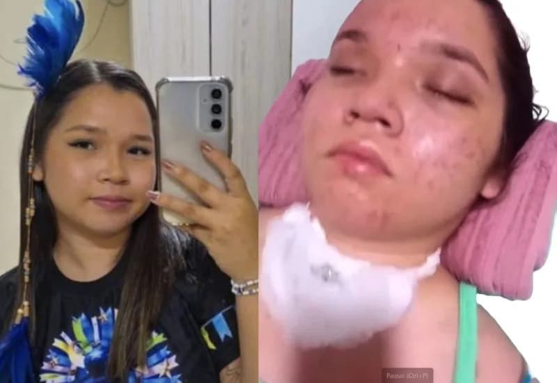 “Ela não se move, não faz nada&#8221;: mãe de Flávia Catarina mostra jovem em estado vegetativo