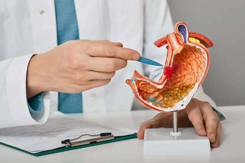Refluxo gastroesofágico: causas, sintomas e riscos à saúde