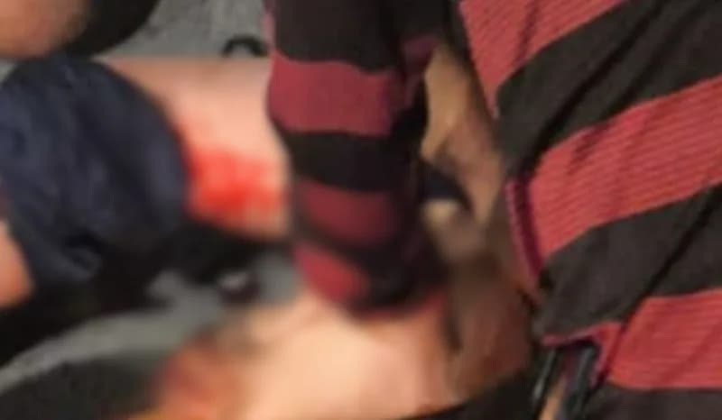 Criança de 10 anos é atropelada enquanto brincava de &#8220;papagaio&#8221; na zona Norte de Manaus