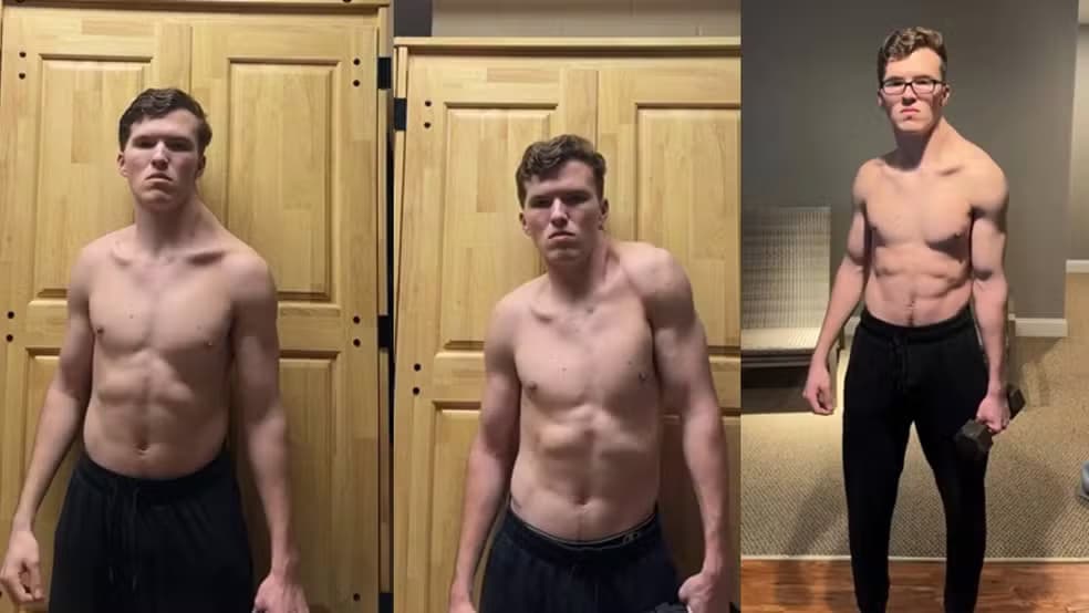 &#8220;Homem torto&#8221;: influencer treina somente um lado do trapézio e viraliza ao mostrar resultado