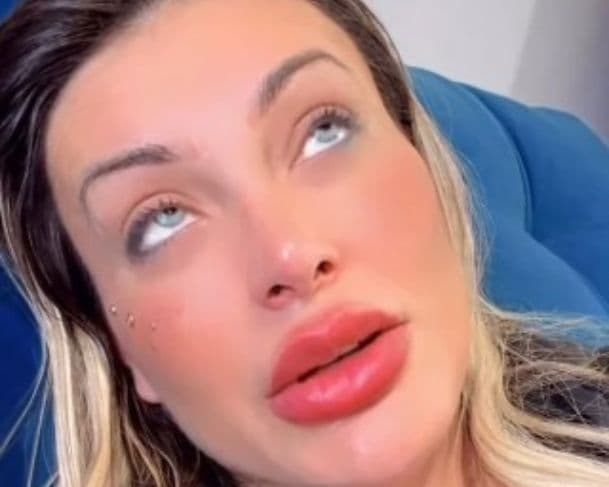 &#8221;Eu achei que ia ficar cega&#8221;, se queixa Andressa Urach com fortes dores da cirurgia que mudou cor dos olhos