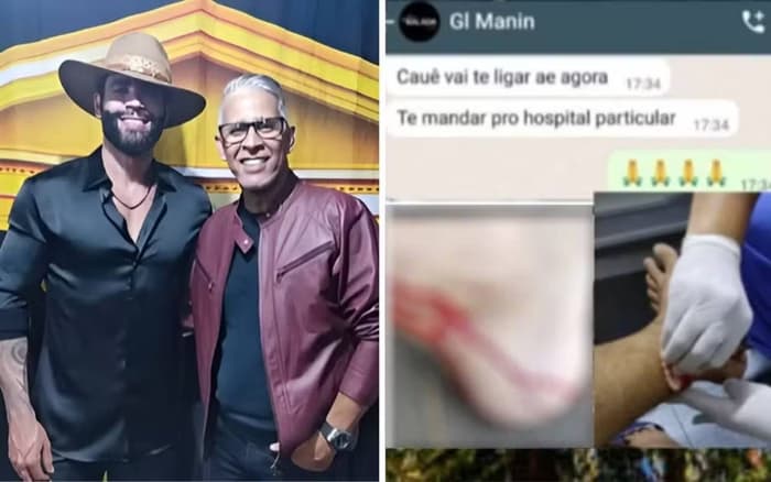 Irmão de Gusttavo Lima é mordido por macaco durante passeio em Goiânia e cantor reage: &#8220;É azarado&#8221;