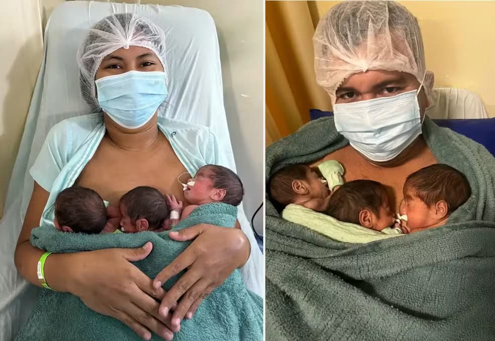 Mãe descobre gravidez de trigêmeos no momento do parto, no Pará