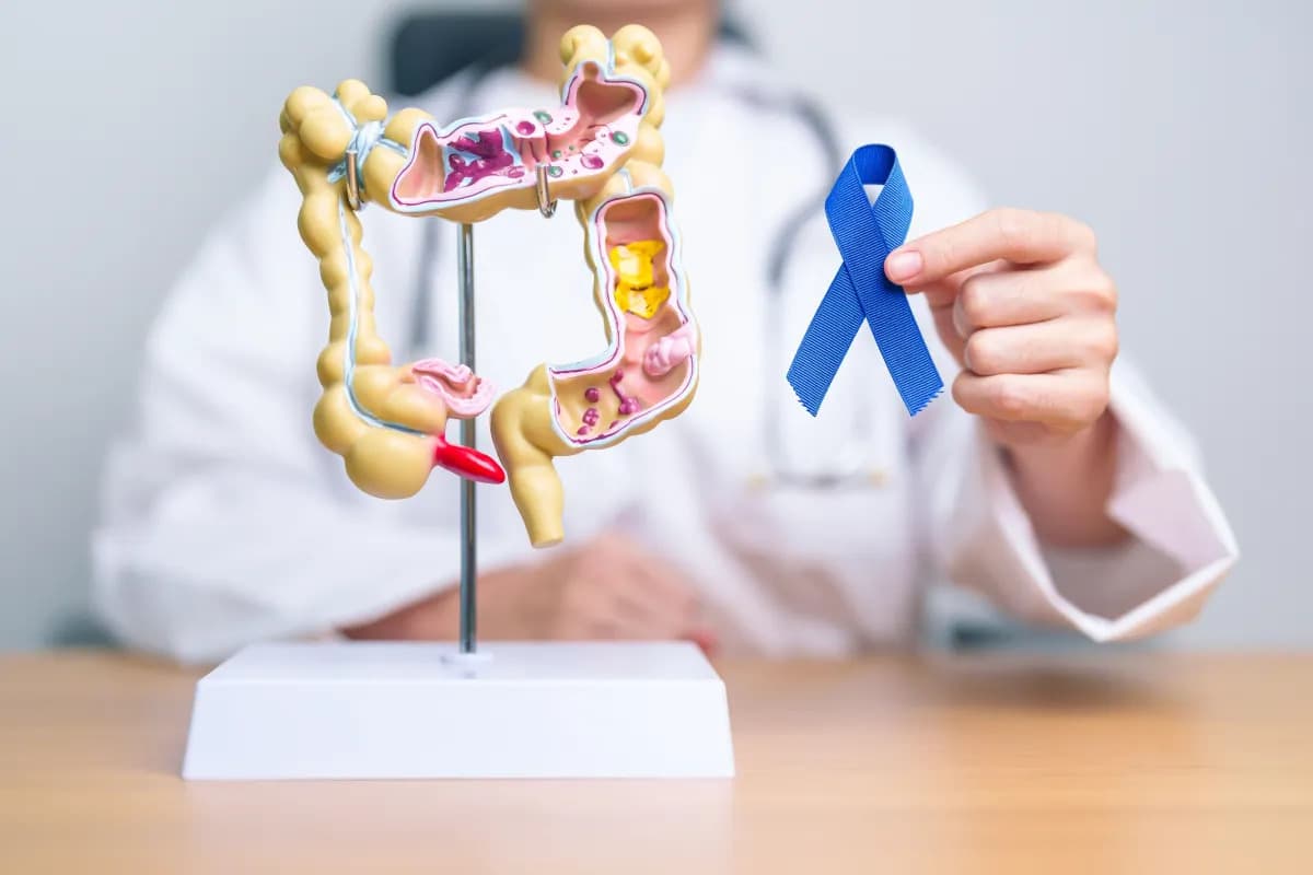 Câncer colorretal: entenda sintomas e como diminuir o risco da doença que vitimou Preta Gil